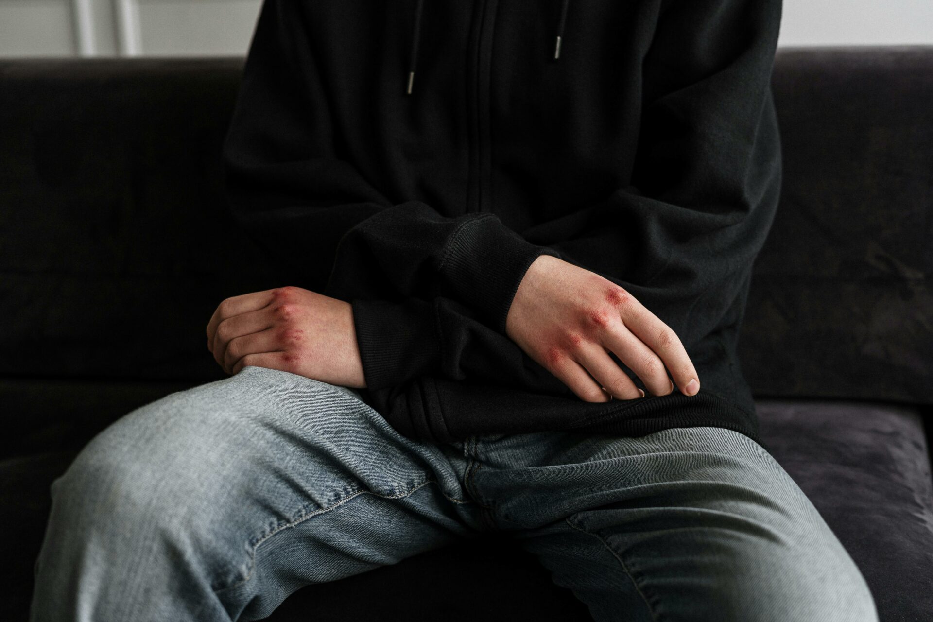 joven con nudillos enrojecidos